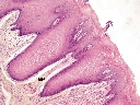 Larynx - p. vestibularis