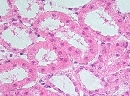 Prox. kanálky - mitochondrie